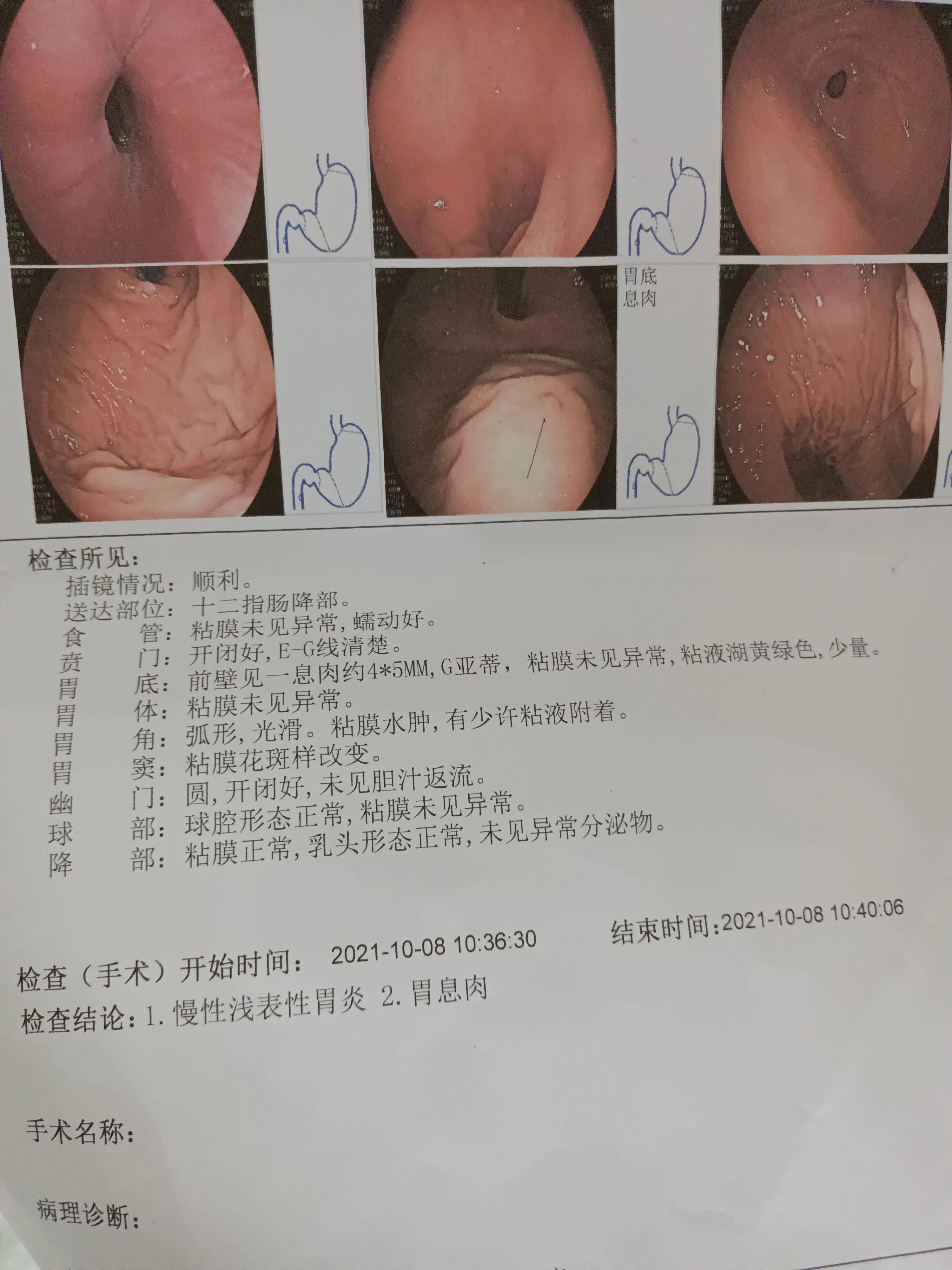 「奇懒观察」「人生体验之无痛胃镜」