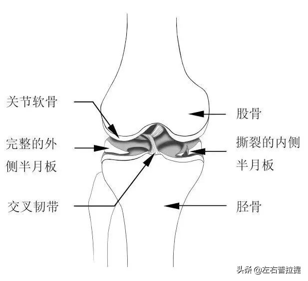 膝关节置换后的康复锻炼方法视频,膝盖痛锻炼膝盖的正确方法