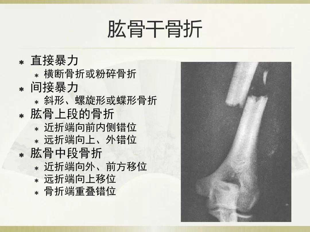 骨科x光片读片技巧,放射科骨科读片教程