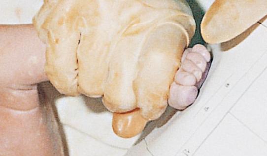 宝宝顺产出生的过程,剖腹产的小孩比顺产的小孩胆小吗