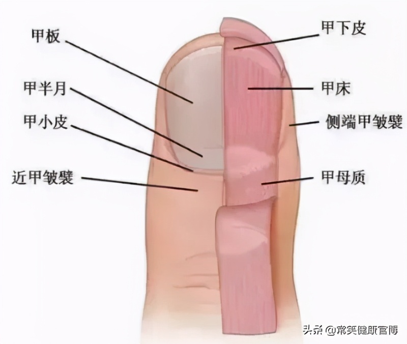 指甲出现各种问题的图片,指甲出现这些症状可能是灰指甲
