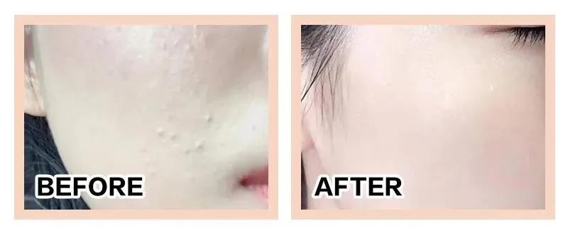 逛超市时看到这些护肤好物,大牌护肤品隐藏好物