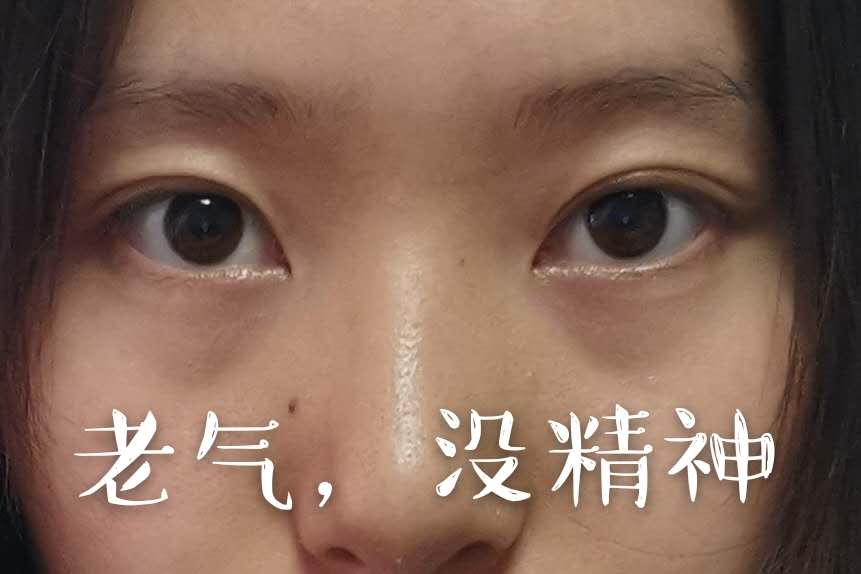 什么颜色遮黑眼圈泪沟比较自然,遮严重的黑眼圈泪沟的教程