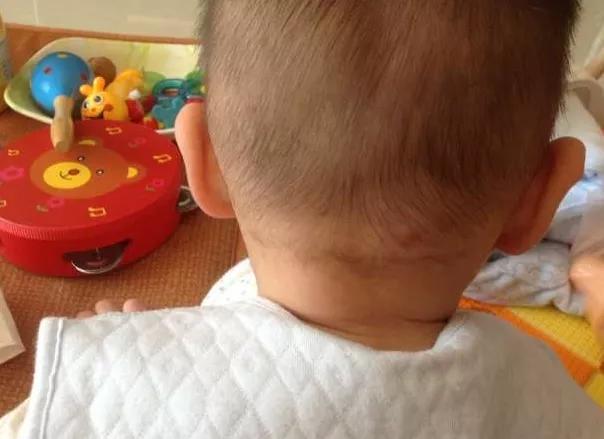 8岁男孩口吐白沫，昏迷入院，医生告知原因，宝爸痛扇自己嘴巴