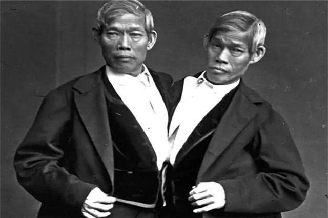 连体兄弟俩娶连体姐妹俩,马戏团连体双胞胎娶妻生子