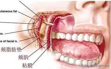 口角囊袋是整形后遗症么,去除口角囊袋恢复过程