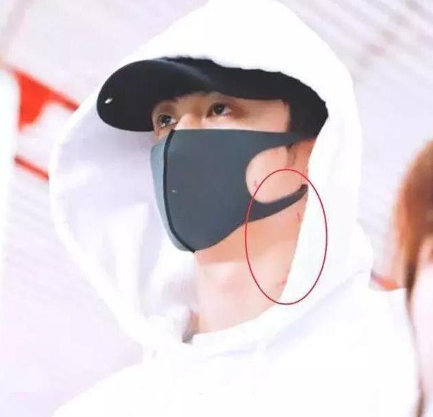 被绿又被打？还为爱自杀？至于吗