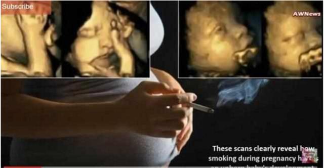 孕妇做四维彩超可以查出宝宝什么,孕妇四维彩超胎儿最佳状态