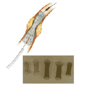 癌症眼部皮肤变色,皮肤黄眼睛黄是什么癌