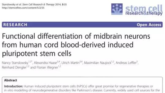 帕金森脐带血,脐带血干细胞治疗帕金森案例