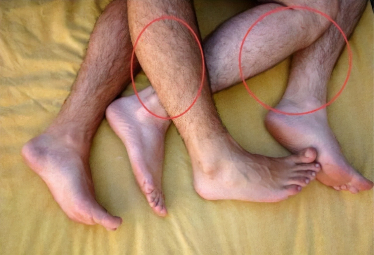 男性腿毛稀少是肾不好吗,男性腿毛少代表什么