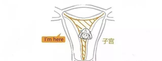 漫画详解子宫肌瘤是个啥?