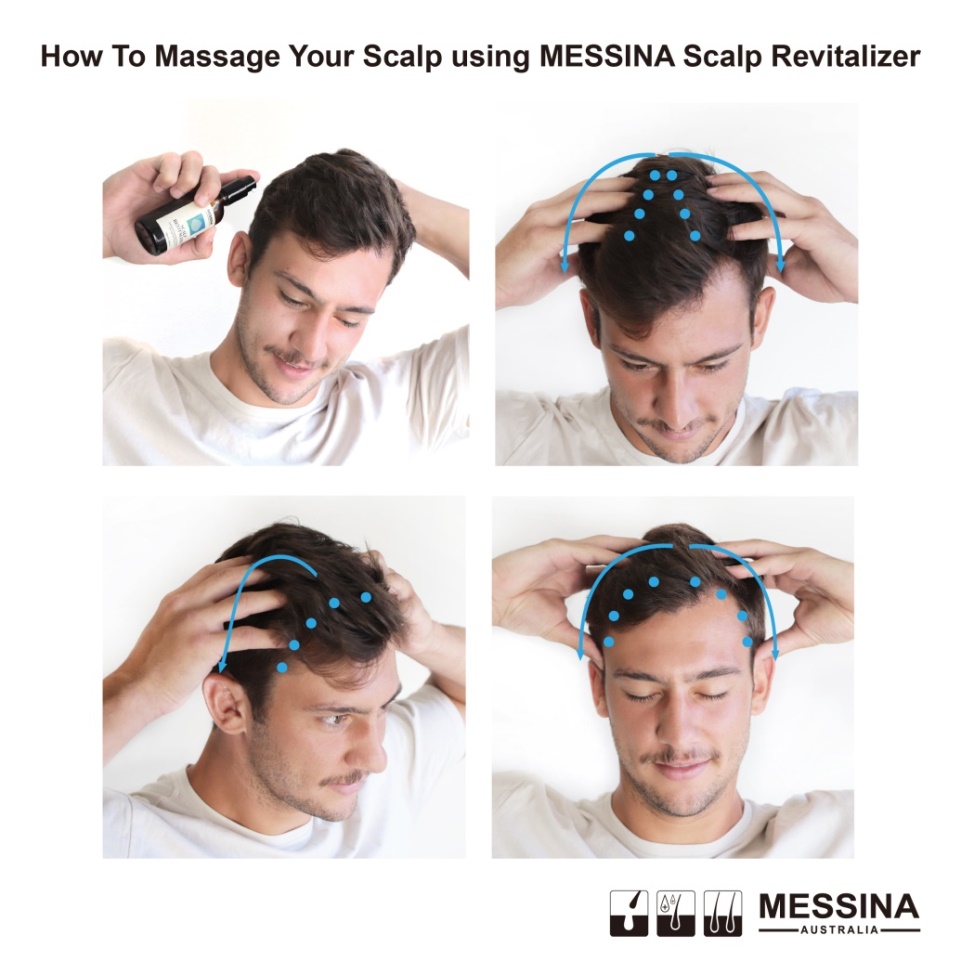 脱发脱成灭霸，我加入了妇愁者联盟！澳洲messina带你找回自信