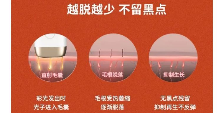 j-style脱毛仪怎么用,j-style脱毛仪怎样