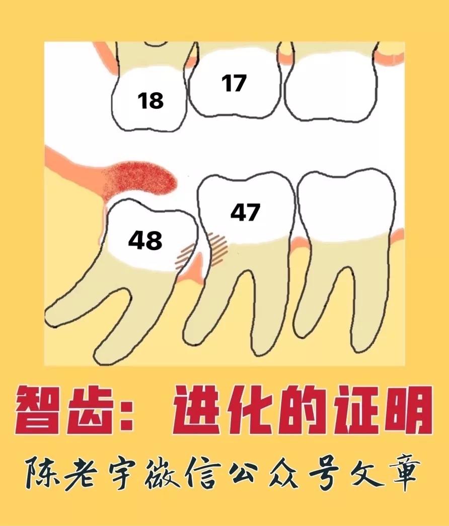 智齿自然进化图片,智齿是进化不完全表现吗