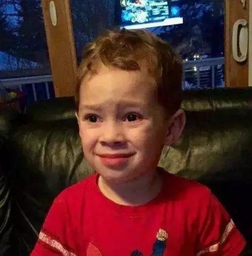 微创手术比开腹手术费用要高吗,微创和开腹手术的区别