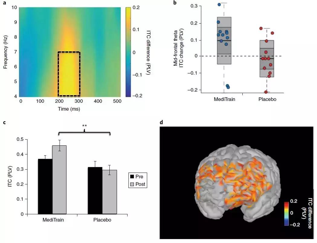 脑科学治疗失眠,脑科学治疗