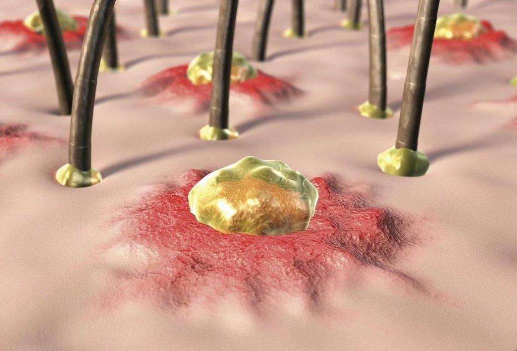 城野医生毛孔收缩水正确使用方法,城野医生毛孔收缩水有效果吗