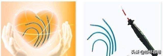 室早患者注意事项,室早严重会对身体有多大影响