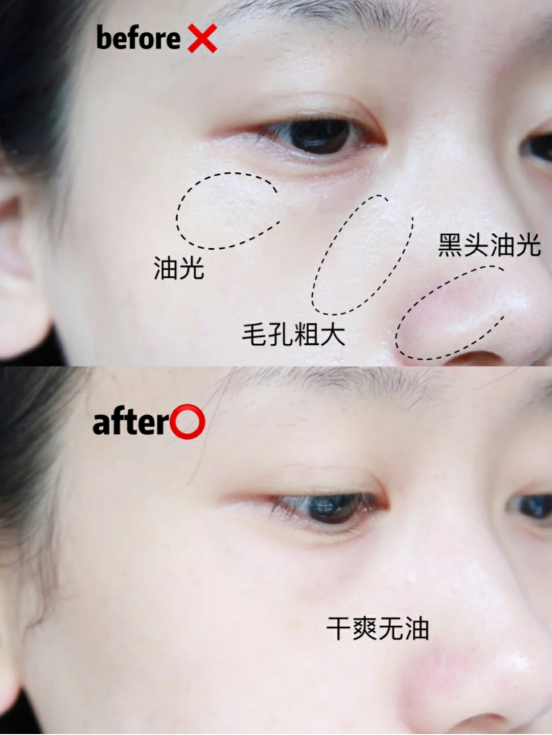 美容仪的真实效果,美容仪最实用的功能