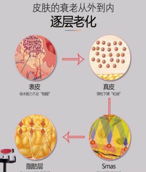 剖腹产疤痕怎么快速消除小妙招,一白遮百丑的调理方法