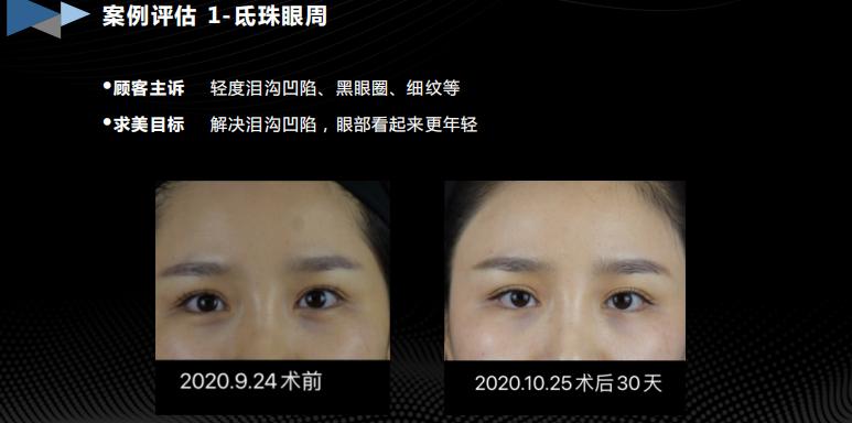 胶生灌养眼周抗衰是什么产品？