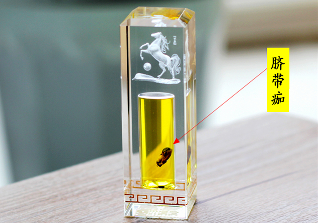 新生儿脐带脱落后的处理方法,新生儿脐带脱落后如何处理