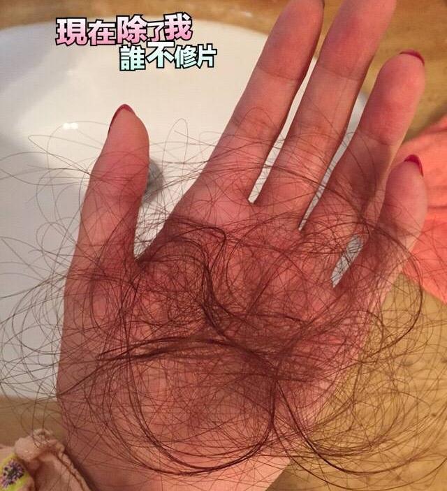 产后脱发妈妈母亲节最实用礼物，每个妈妈都值得过上美美的生活！