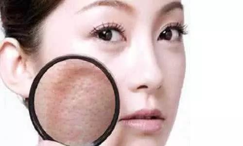 脸上有痘印痘坑毛孔粗大怎么解决,为什么痘坑形成需要时间