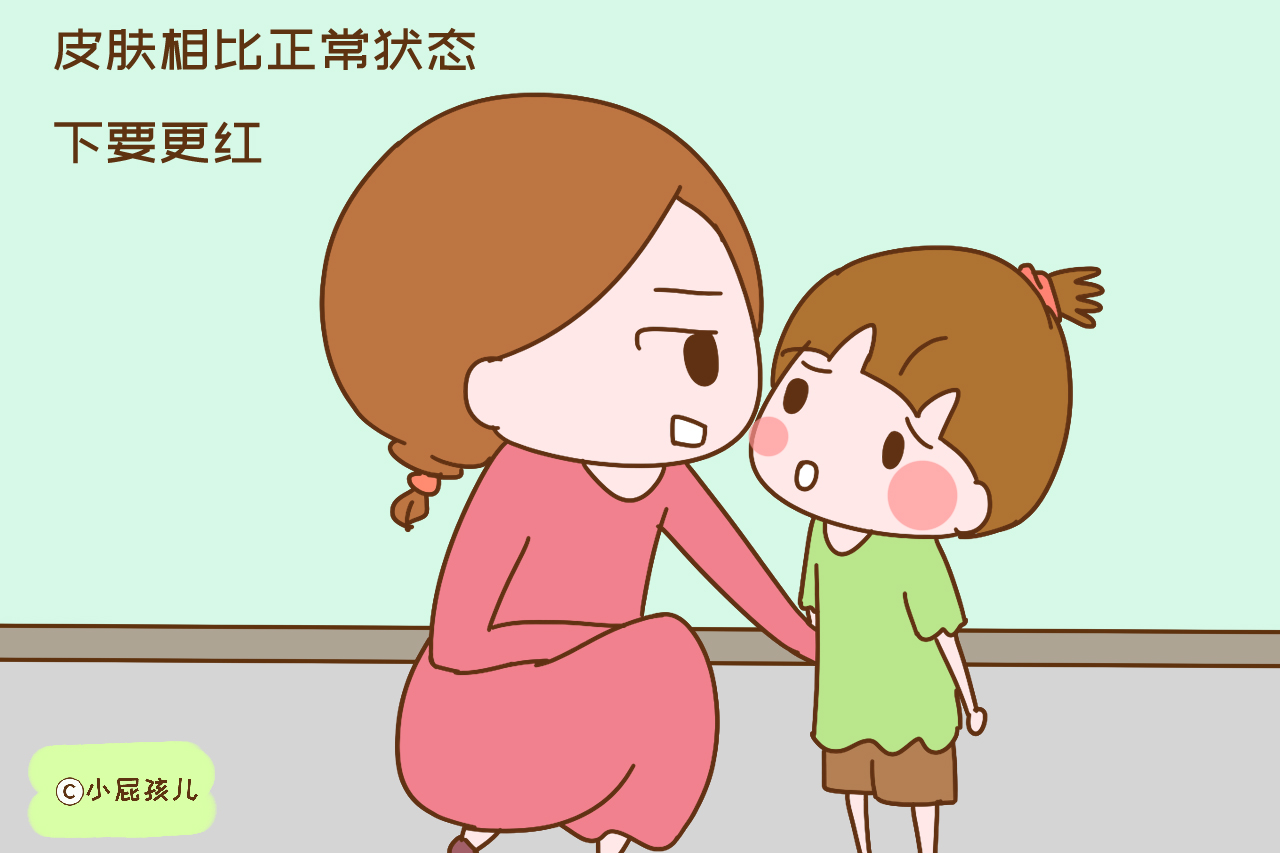 孩子中暑的症状和表现,小朋友什么症状是中暑