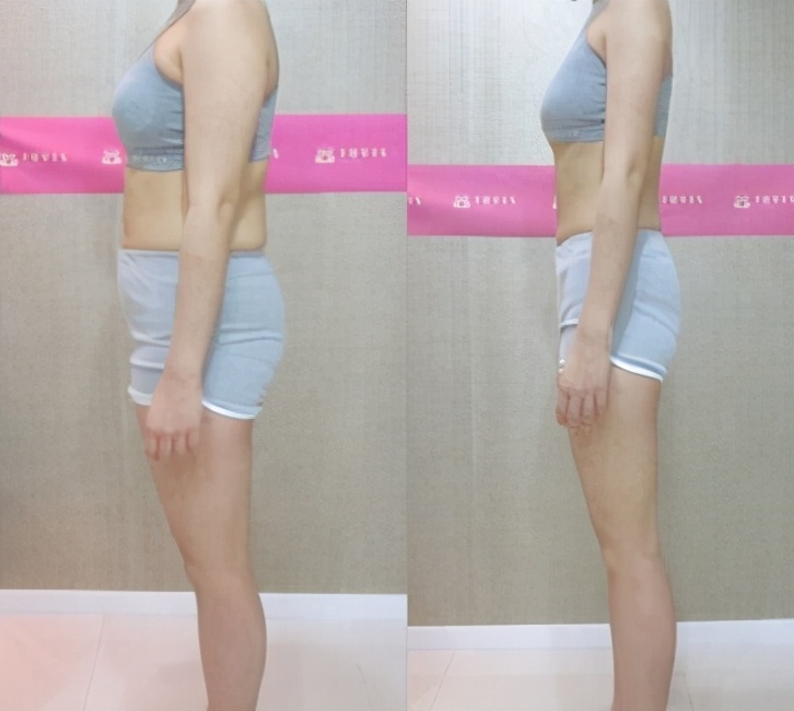 别人生完看不出,自己生完回不去,“产后易瘦体质”有哪些特征?