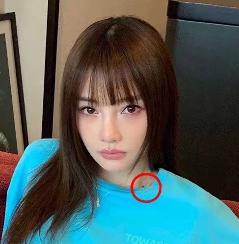 破案了！李小璐脖子“吻痕”不是贾乃亮种草莓，点痣身上没黑点