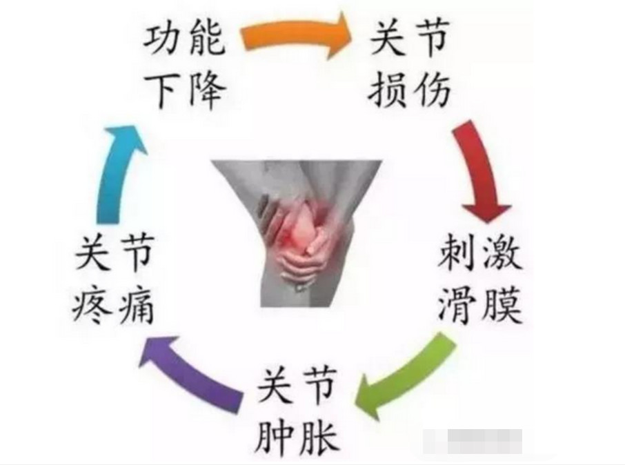 膝关节滑膜炎肿胀不消是怎么回事,膝关节不明原因疼痛是怎么回事