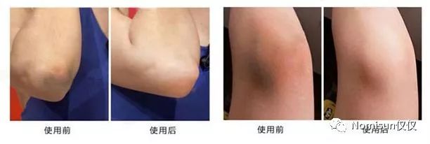 鐢风敓姝㈡,鐢风敓姝㈡浜庢毀鏄ф湡