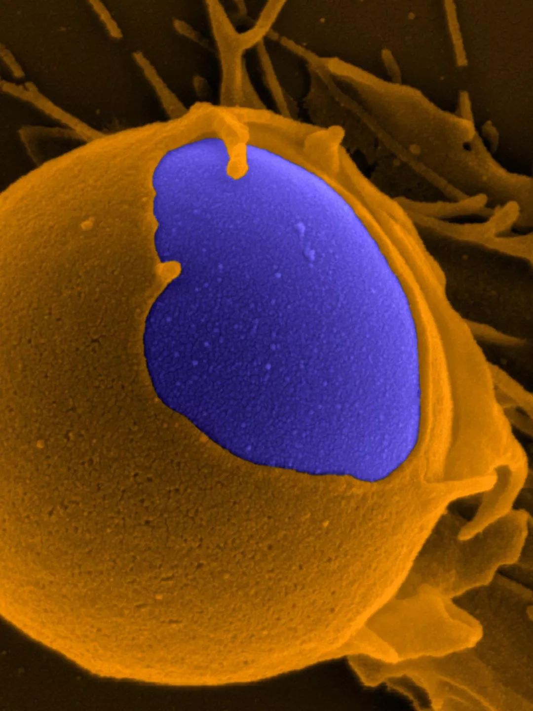 鍋囧鐥呮瘨鎰熸煋浜嗘垜,鍋囧鐥呮瘨鎰熸煋浜嗕綘