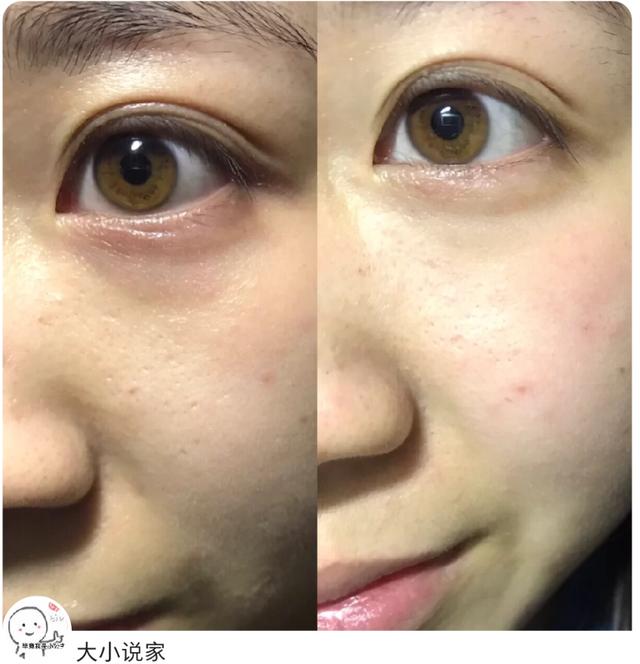 精选5款贵妇眼霜推荐,4大眼霜