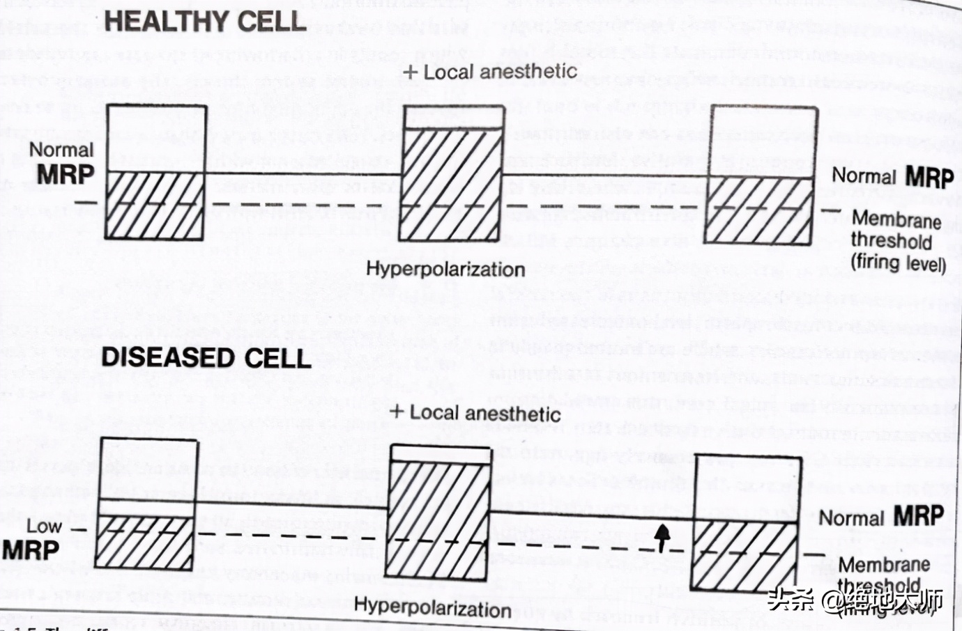 膝关节术后慢性疼痛神经调控康复方案
