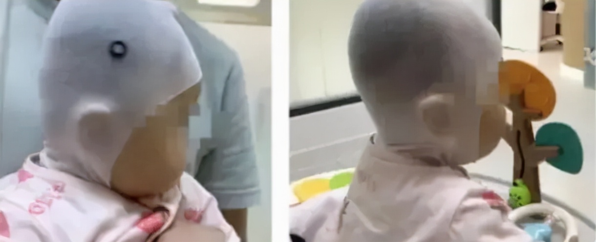 一岁宝宝睡偏头戴婴儿矫正头盔,七个月宝宝戴头盔多久能纠正头型