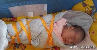 小朋友O型腿，X型腿，需要干预吗，怎么矫正？骨科医生告诉你