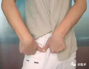 骨科急救处理流程图,骨科急救原则及注意事项