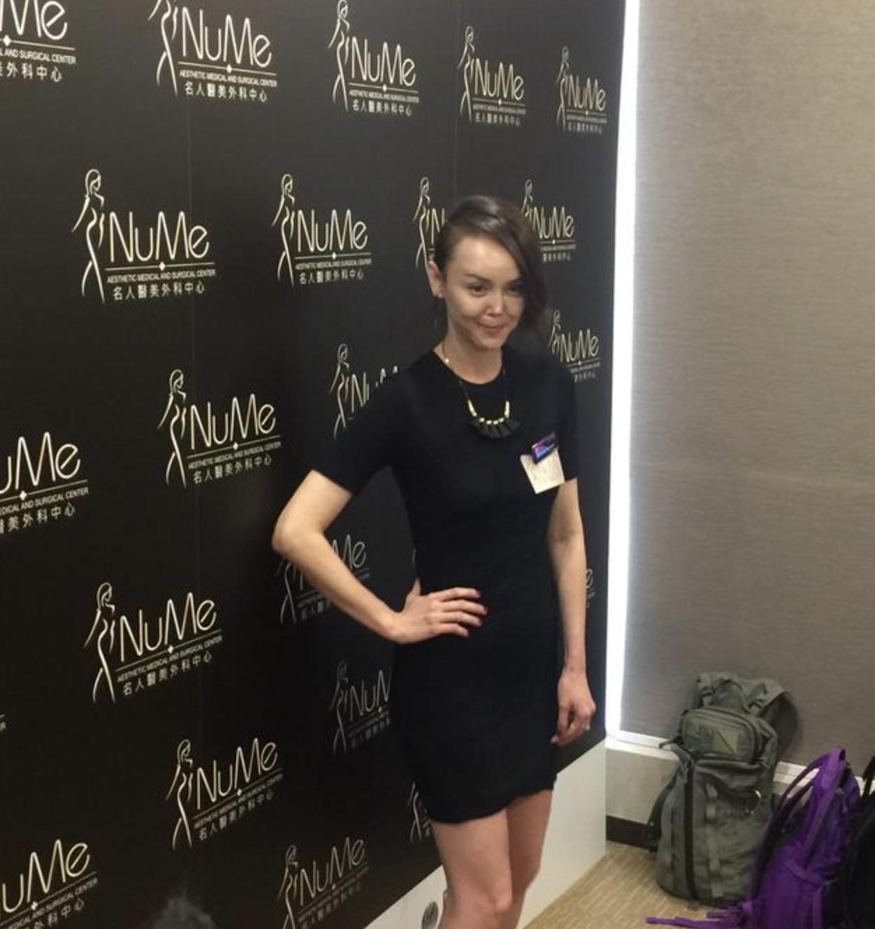 韩君婷的鼻子是整容失败吗,韩君婷鼻子受伤原因