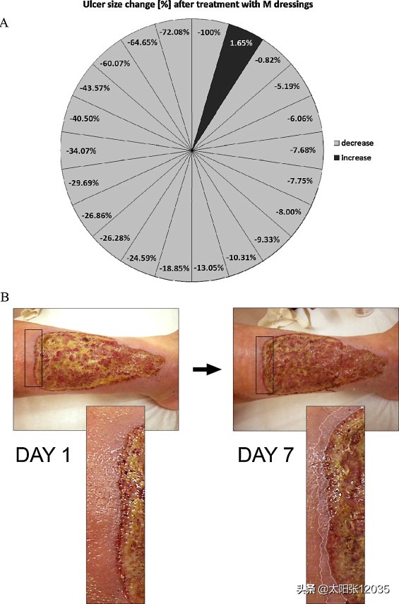 生物塑料纤维，学习翻译