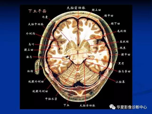 mra头颅解剖学详细讲解视频,常见的头颅mri图像