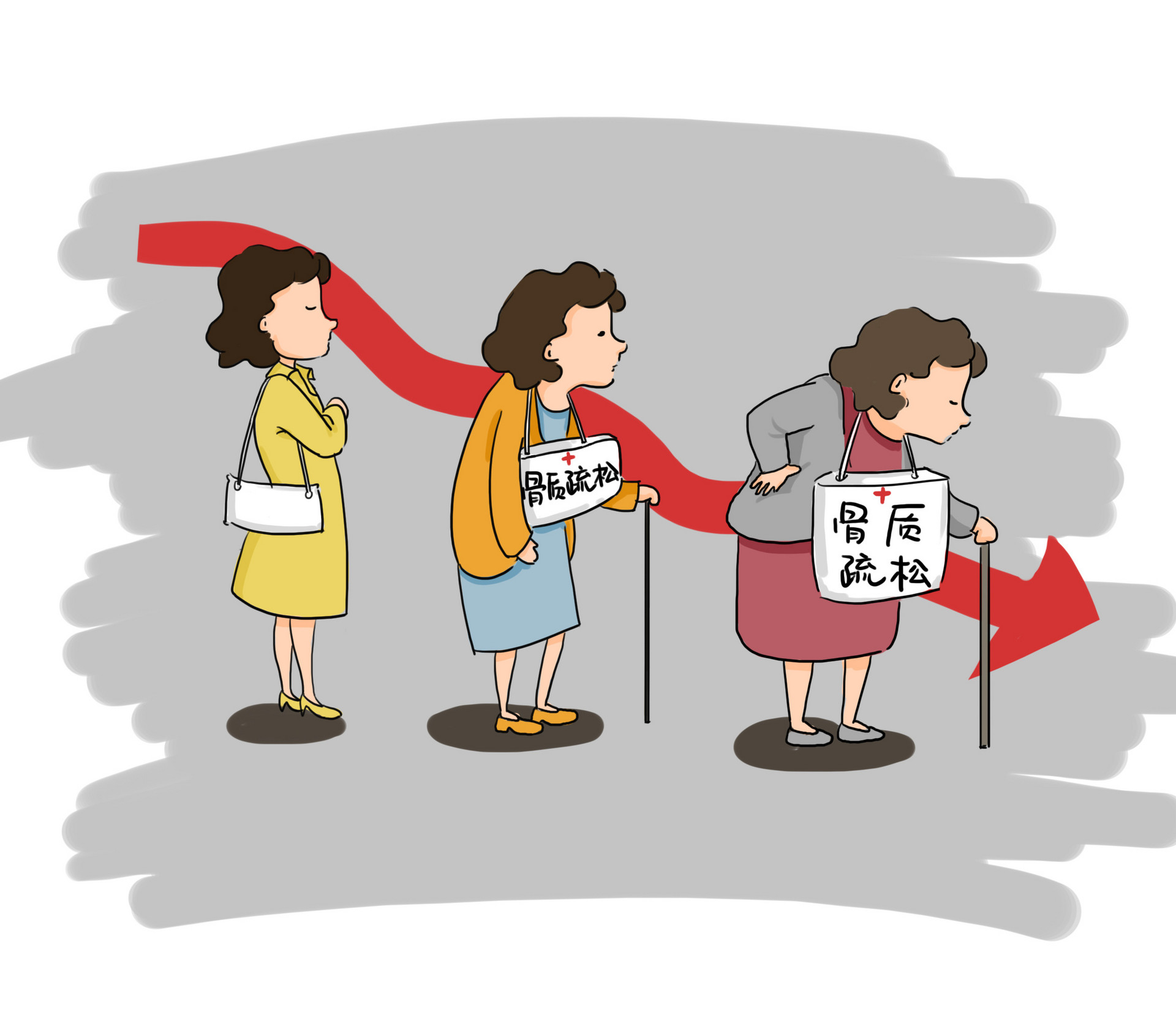 补钙过量会对骨骼有什么影响,宝妈过量补钙对宝宝有影响吗