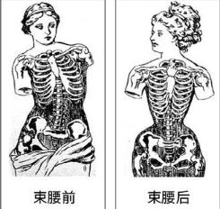 矫正腰带是智商税吗,塑形腰带是智商税