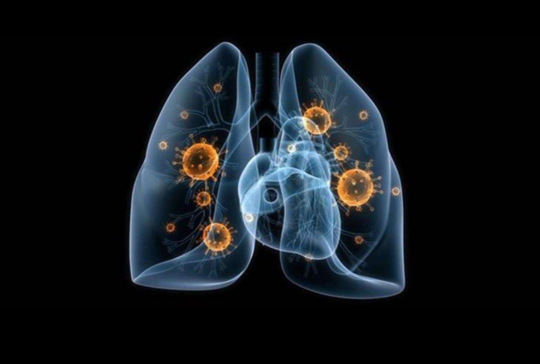 儿童肺炎支原体感染的症状和表现,宝宝肺炎支原体感染最有效的方法