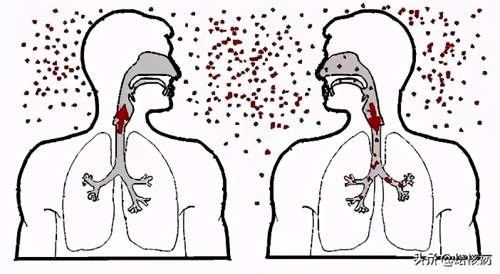 肺结核耐药了治疗是怎样的,肺结核耐药治疗方案有几种药