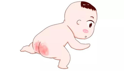 湿疹对颜值的影响,宝宝湿疹影响颜值吗