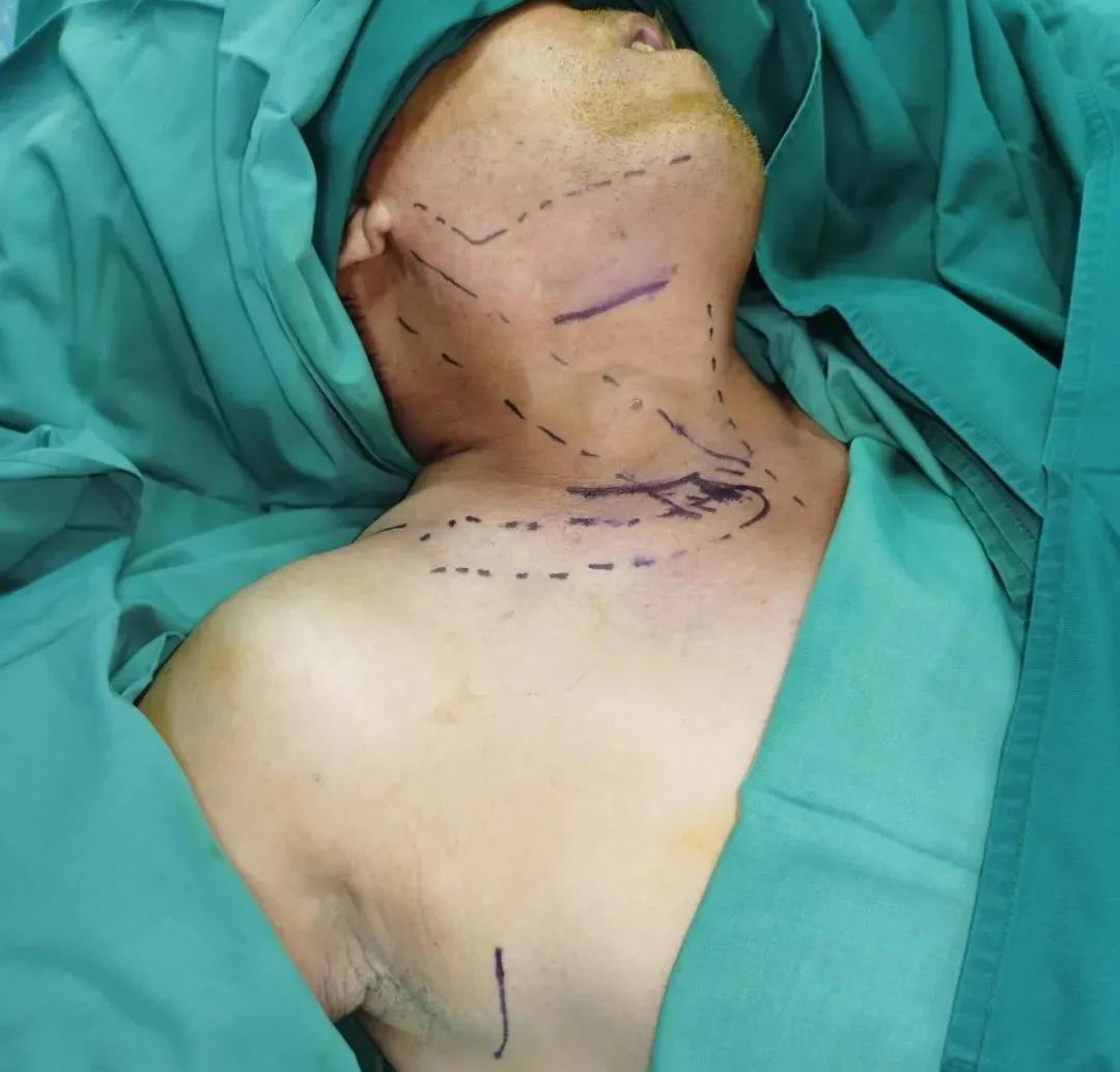 多么痛的领悟这句话是什么意思,嗓子疼感冒的感悟