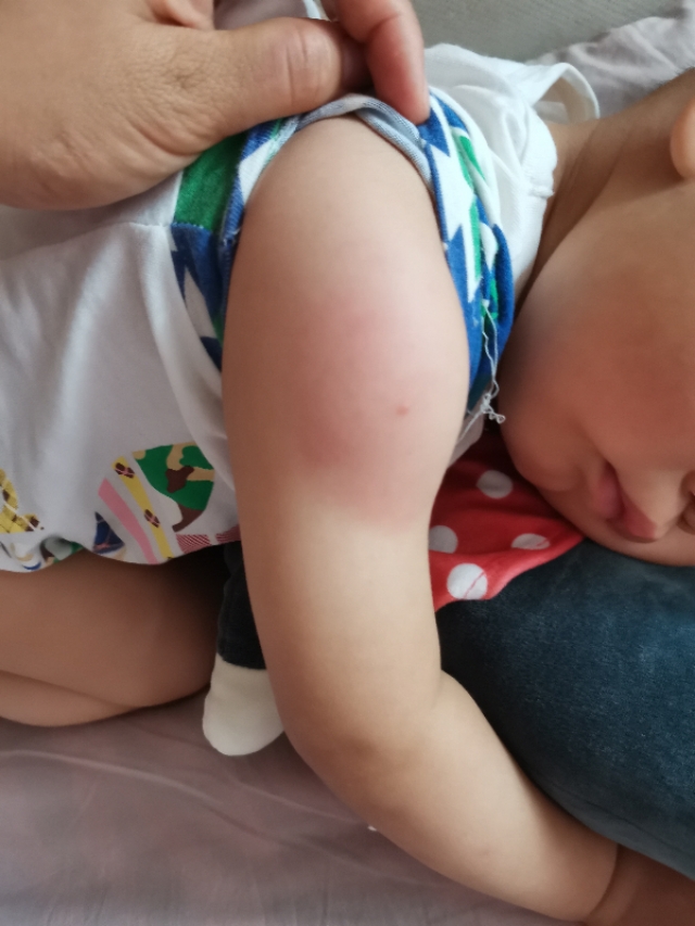 孩子发烧打完针抽搐晕倒什么原因,打完预防针抽搐